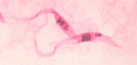 chagas.jpg