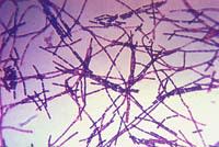Bacillus_anthracis_Gram.jpg