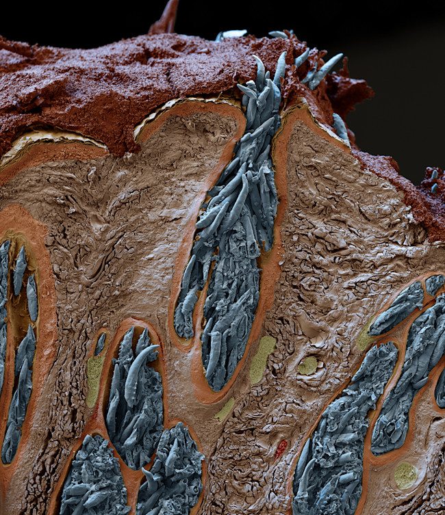 Face Mites - Science Source
