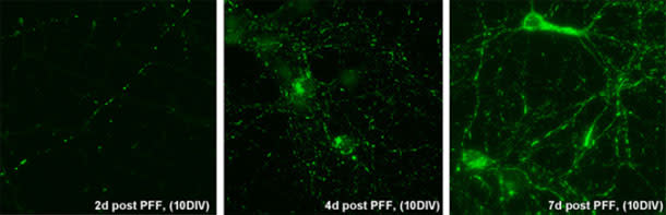 Alpha-synuclein.jpg