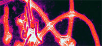 Viruses.jpg
