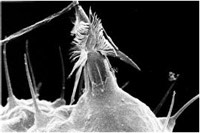 Nematocyst.jpg