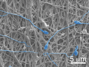 fibers-and-sperm1-300x228.gif