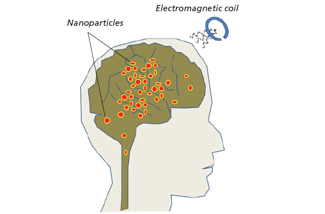 brain-diagram.jpg