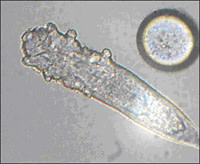 demodex sm
