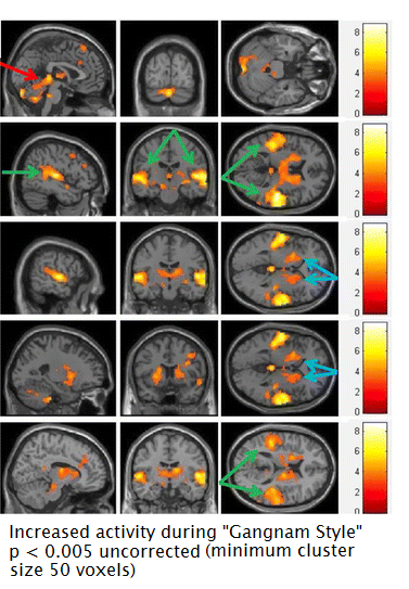 fmri_gangnam-1.png