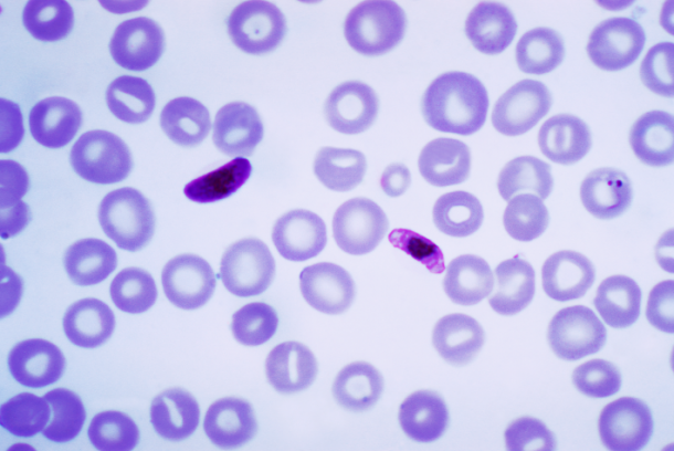 Malaria-610x408.png
