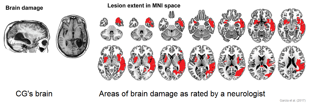 cg_brain.png