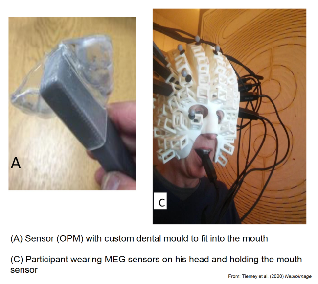 Mouth sensor for MEG