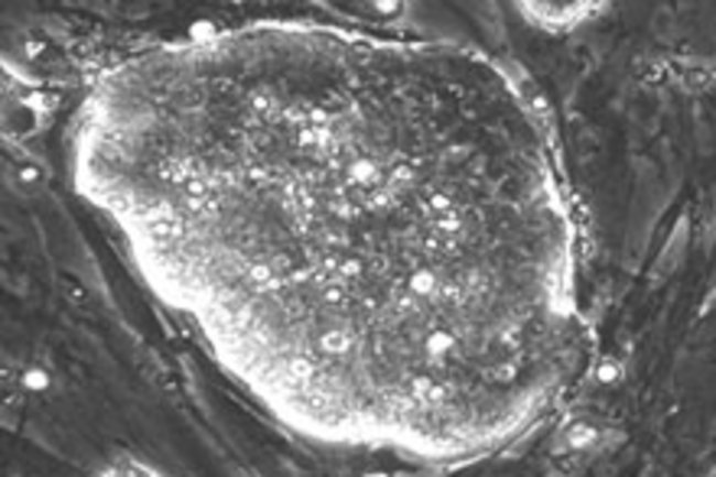 stem-cell.jpg