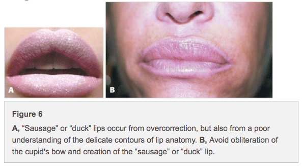 duck_lips.png