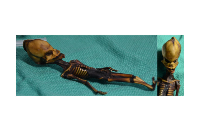A mummified skeleton only six inches long, found in Chile's Atacama Desert, stirred up controversy. Bhattacharya S et al. 2018