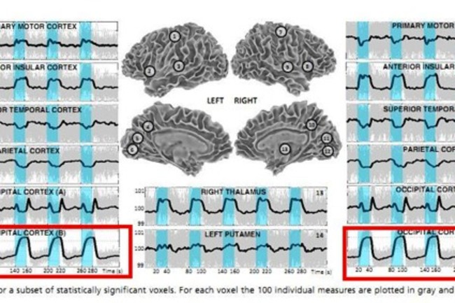 brain-iceberg-620.jpg