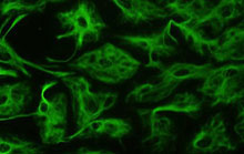 Star-Shaped Brain Cells May Provide the Actual Food for Thought ...