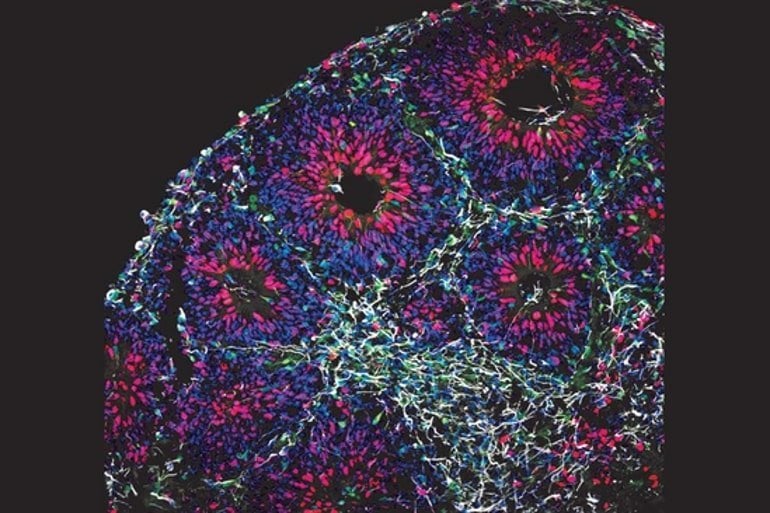 The fractal brain, from a single neuron's perspective - The Source
