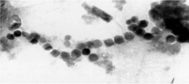magnetosomes