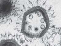 Viralcapsid.jpg