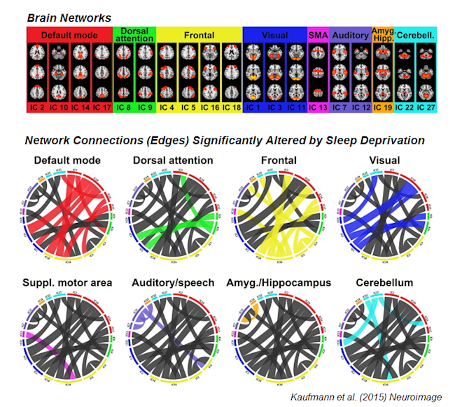 kaufmann_sleep_fmri.png