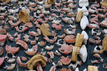 dentures.jpg