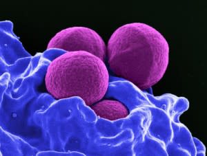 microbes-300x227.jpg