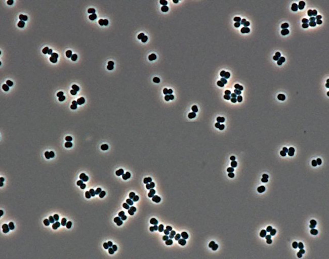 Tersicoccus phoenicis - NASA