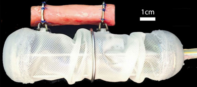 robo-implant.jpg