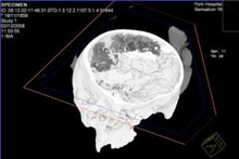 iron-age-brain.jpg