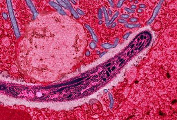 Plasmodium1.jpg