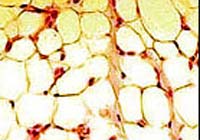 Adipocytes.jpg