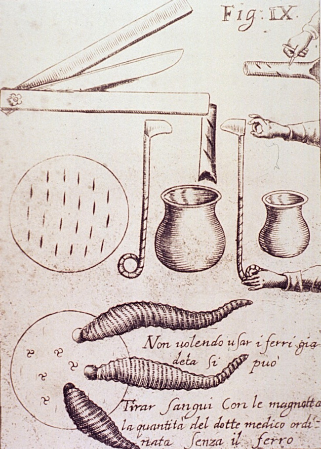 bloodletting_tools_leech-732x1024.jpg