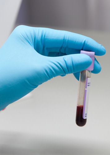 blood-sample.jpg