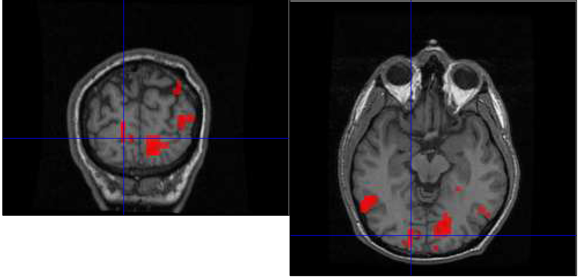 Jonathon Keats brain scan - Courtesy