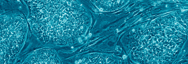 Embryonic-stem-cells.jpg