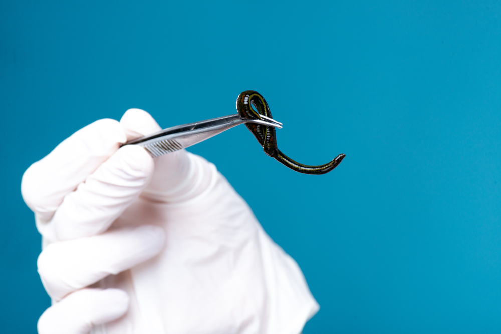 leeches for blood removal