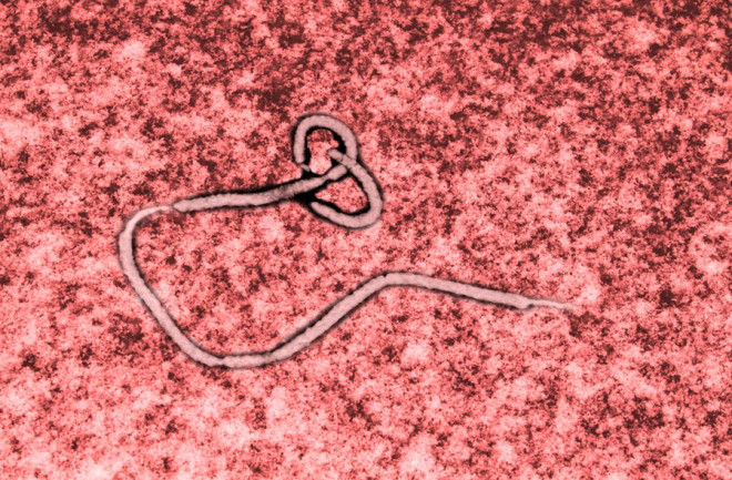 Ebola virus - Shutterstock