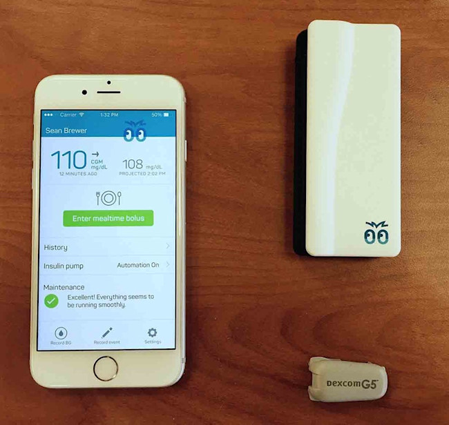 Bigfoot Biomedical artificial pancreas