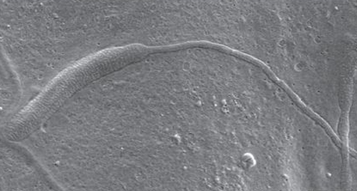 worm-sperm.jpg