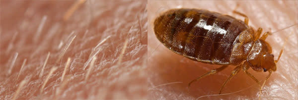 Vellus_bedbug.jpg