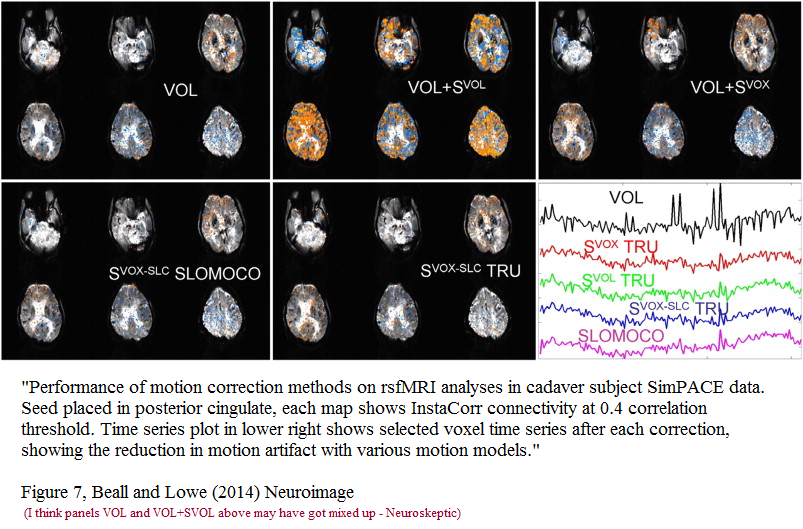 cadaver_fmri1.png