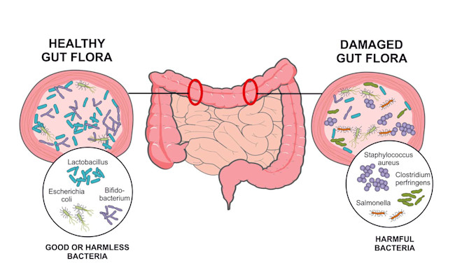 Microbiome Explainer
