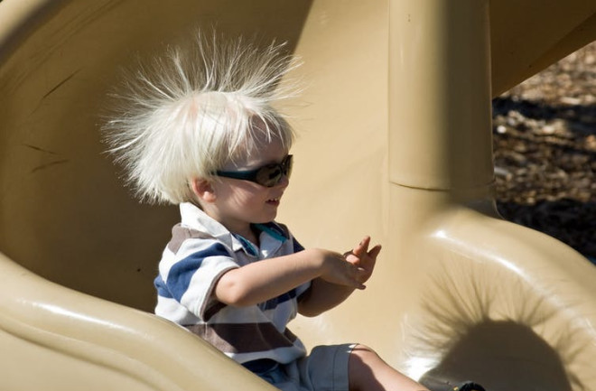 Static Electricity Hair On End - CCBY