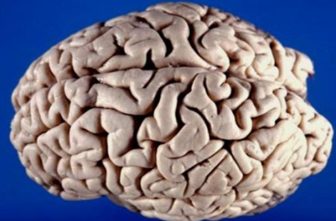 brain-425x289.jpg