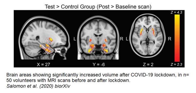 Has The Stress of COVID Affected Our Brains?