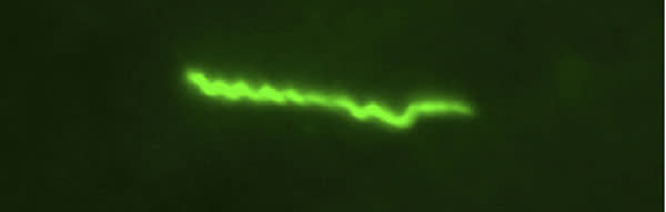 Spiroplasma.jpg