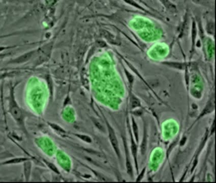 stemcell-425x359.jpg