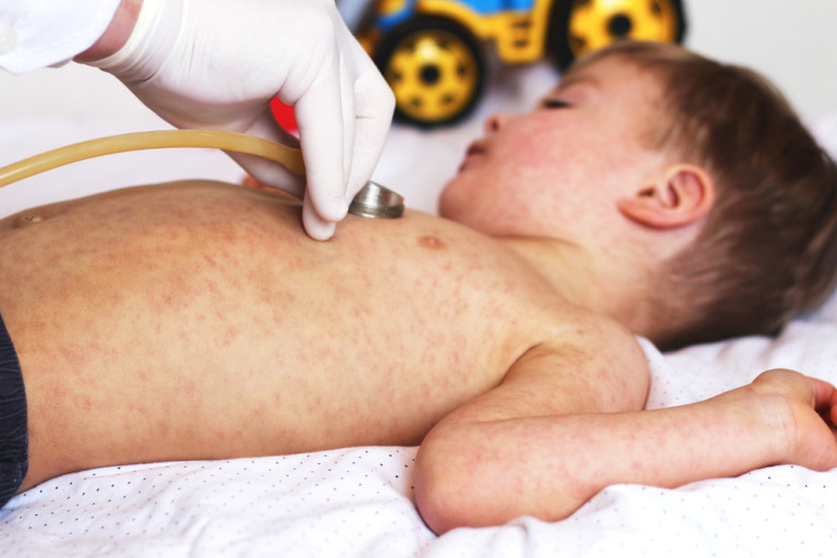 Kids Aren’t Spared From the Coronavirus. A New Inflammatory Condition in Children is on the Rise.