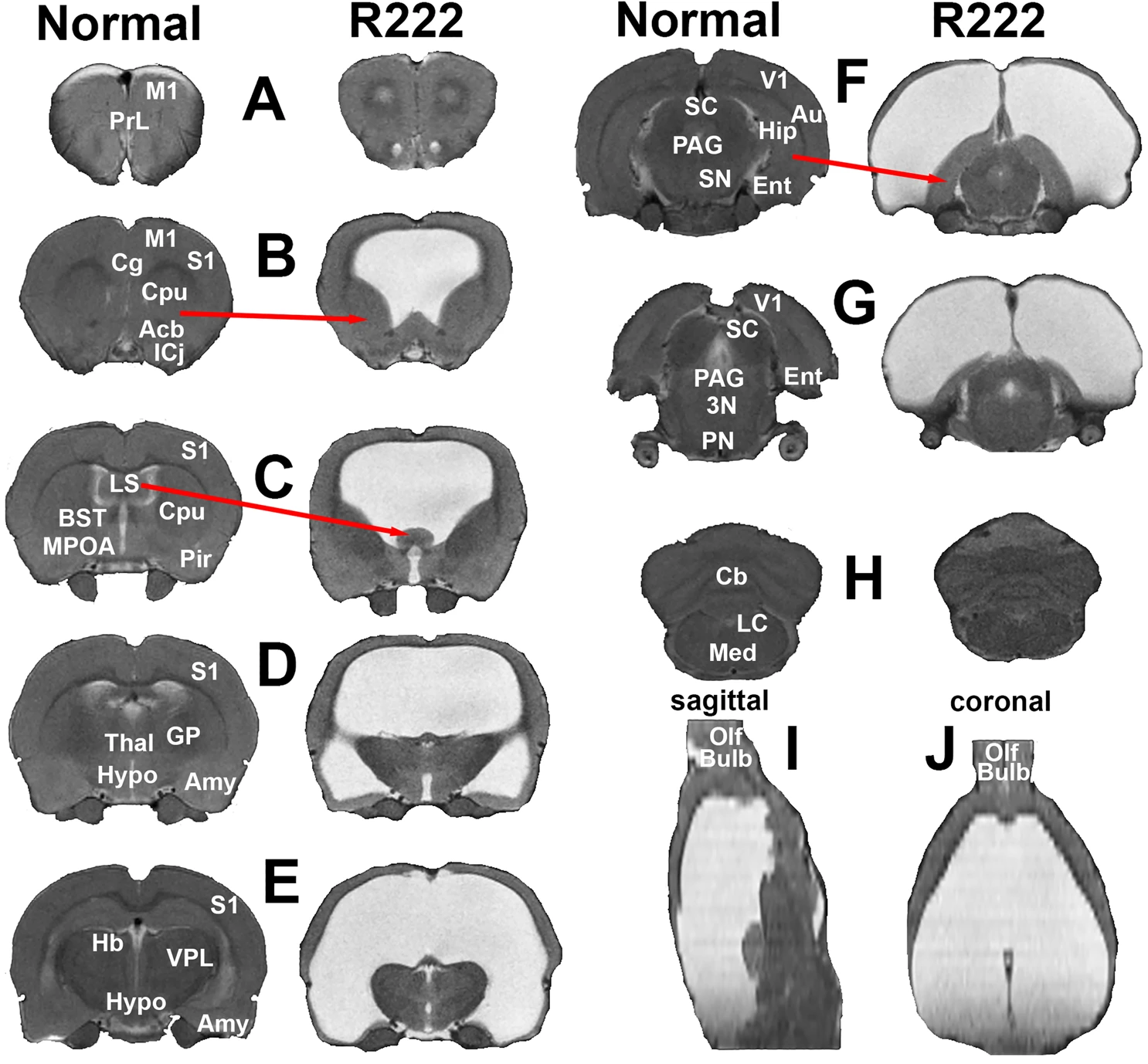 Brain of rat R222 compared to a normal rat