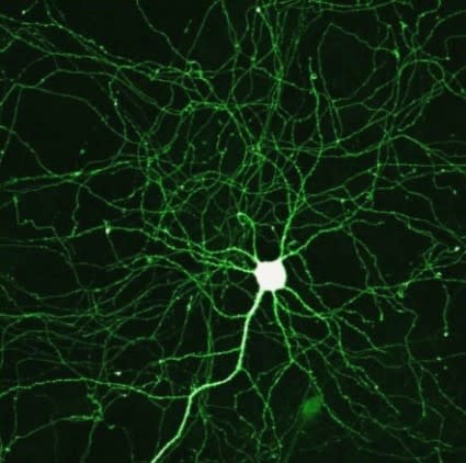 greenneuron-425x422.jpg
