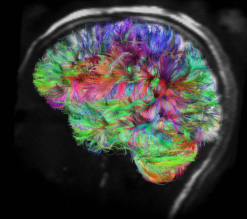human brain mapping project