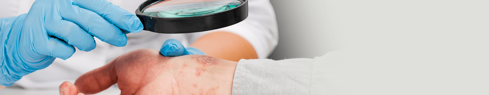 Enfermedades más comunes de la piel del hombre